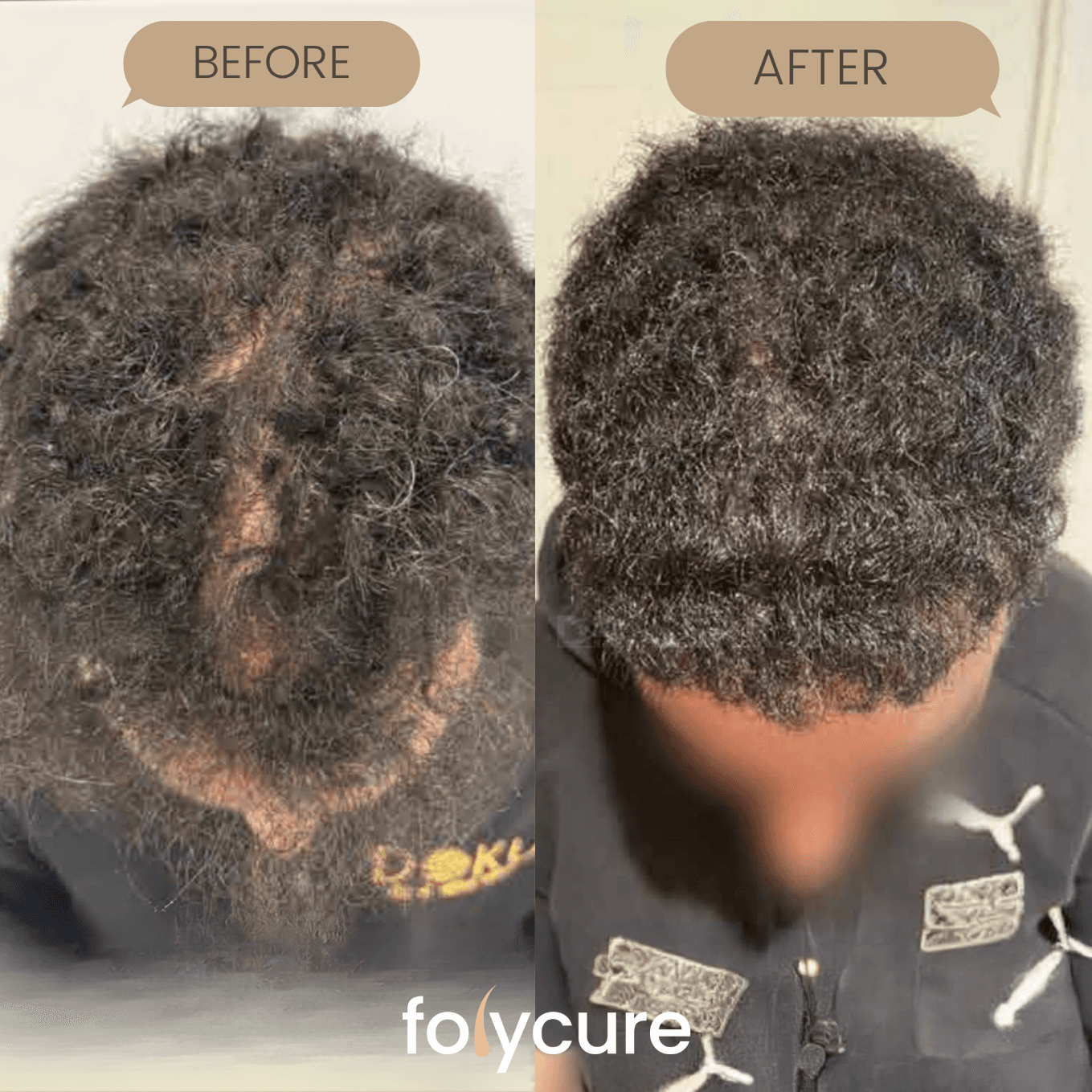 Before and after example