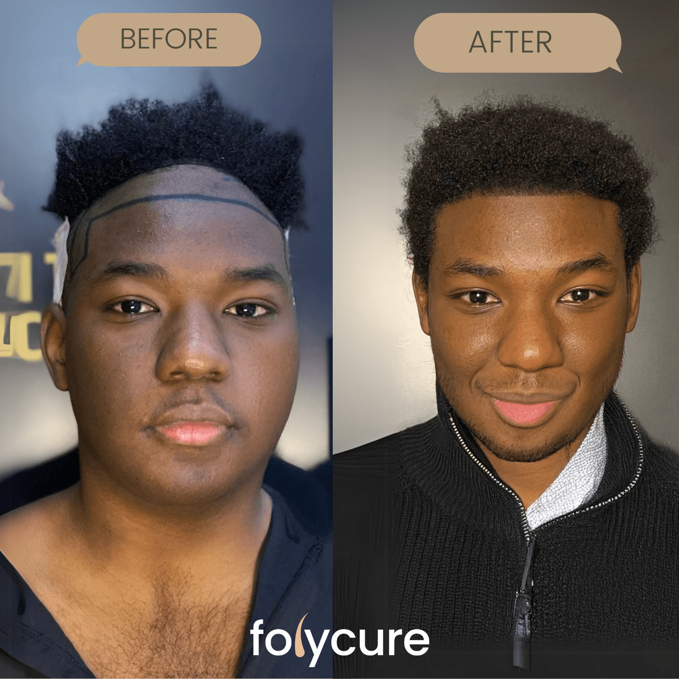 Before and after example